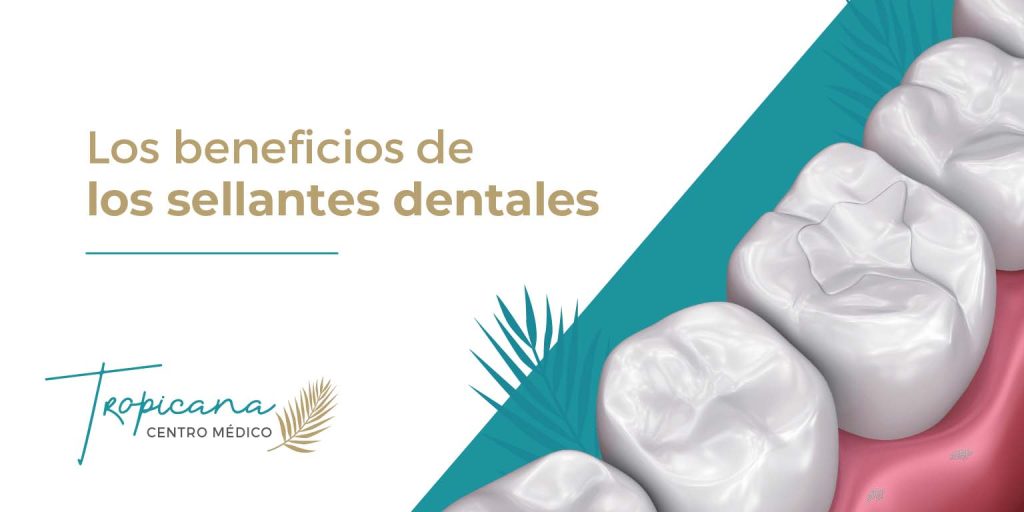 Los Beneficios De Los Sellantes Dentales Centro M Dico Tropicana