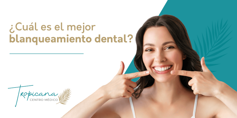 ¿Cuál es el mejor blanqueamiento dental_
