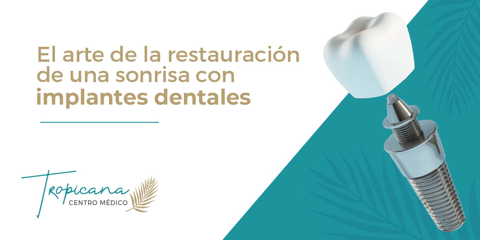 implantes dentales