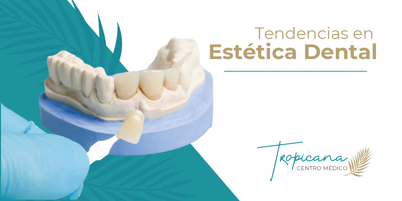 Tendencias en Estética Dental: Hacia Sonrisas Más Naturales